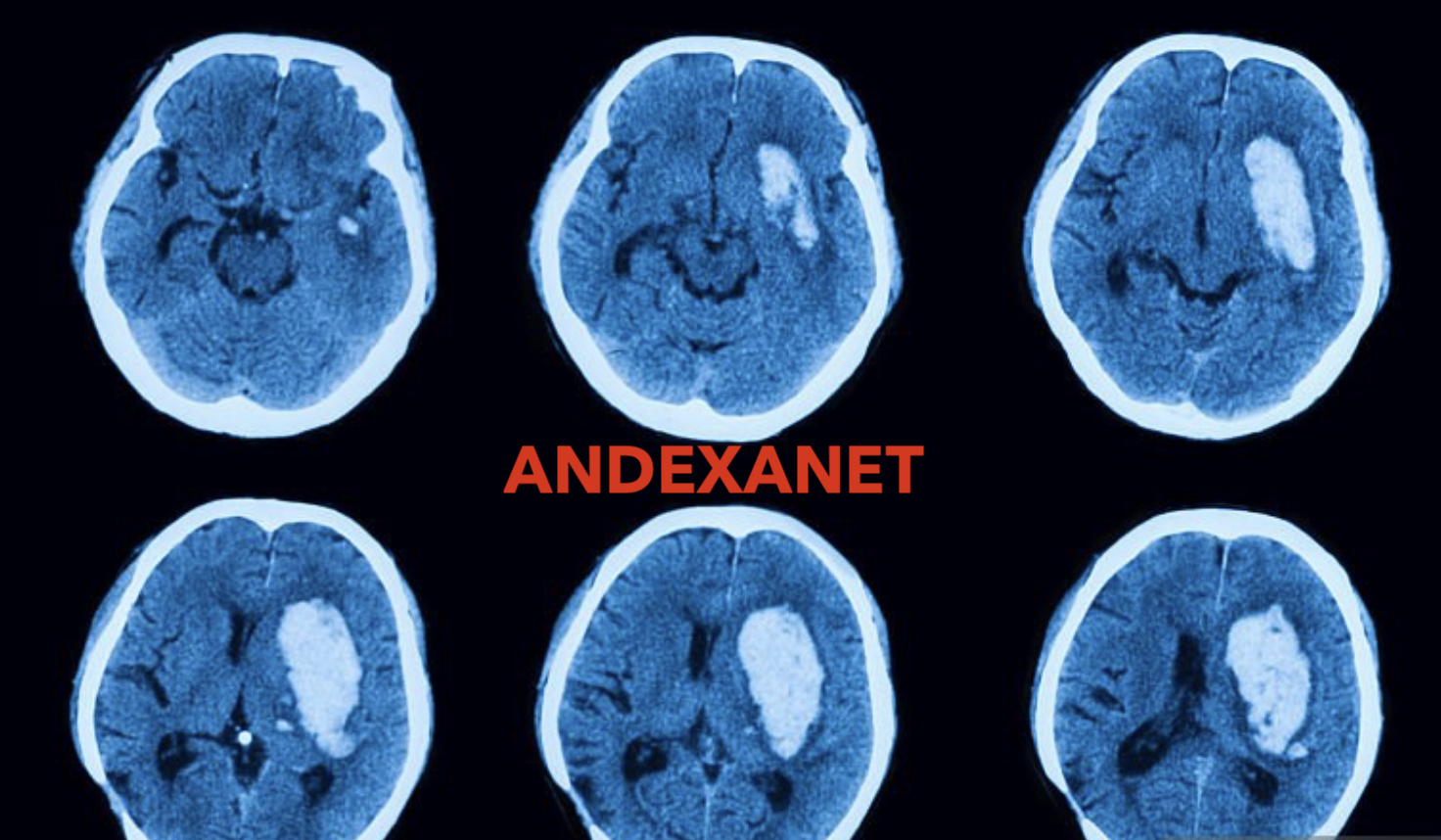 ANNEXA-I: Andexanet for Factor Xa Inhibitor-Associated Acute Intracranial Haemorrhage